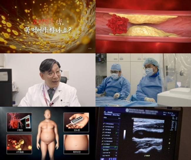 명의 968회 고지혈증 약, 꼭 먹어야 하나요?